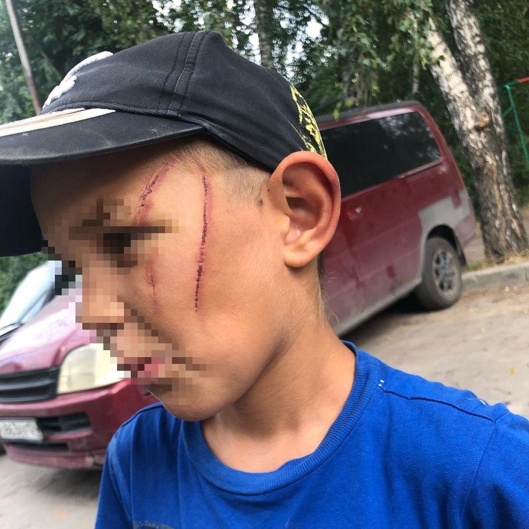 Фото Новосибирец избил 7-летнего мальчика проводом от утюга в воспитательных целях 2